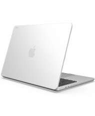 Чехол для ноутбука Moshi Ultra Slim Case iGlaze Stealth Clear for MacBook Air 15.3" M2 (99MO231501)